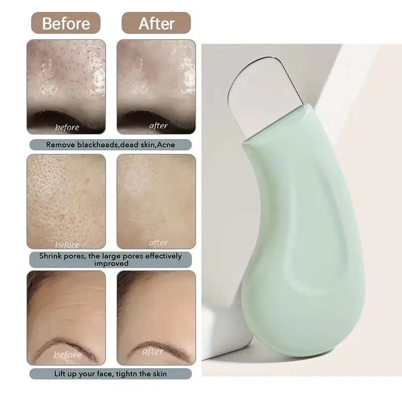 New 1Pc Blackhead & Whitehead  - Nasal Aspirator review and price