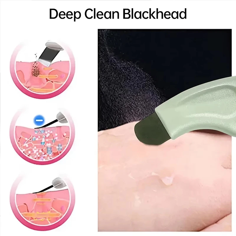 New 1Pc Blackhead & Whitehead  - Nasal Aspirator review and price